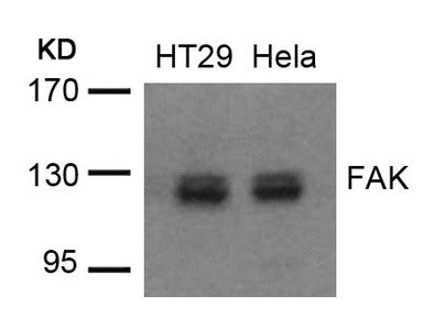 Western blot analysis of extracts from HT29 and Hela cells using FAK(Ab-576/577) Antibody.