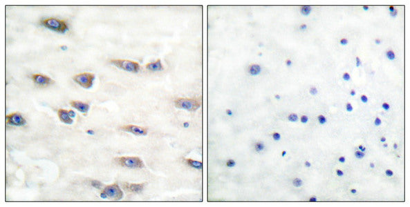 Immunohistochemical analysis of paraffin-embedded human brain tissue, using Trk A (phospho-Tyr791) antibody (left)or the same antibody preincubated with blocking peptide (right).