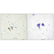 Immunohistochemistry analysis of paraffin-embedded human brain tissue, using ACTR-1C antibody.