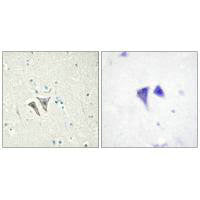 Immunohistochemistry analysis of paraffin-embedded human brain tissue, using ACTR-1C antibody.