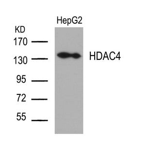 Western blot analysis of extracts from HepG2 cells using HDAC4(Ab-632) Antibody.