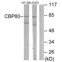 Western blot analysis of extracts from HT-29 cells and LOVO cells, using NCBP1 antibody.