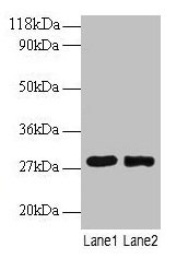 Western blot All lanes: MPZ antibody at 2µg/ml Lane 1: 293T whole cell lysate Lane 2: EC109 whole cell lysate Secondary Goat polyclonal to rabbit IgG at 1/15000 dilution Predicted band size: 28, 35 kDa Observed band size: 28 kDa