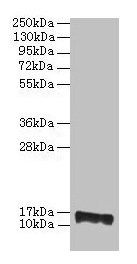 Western blot All lanes: PMP2 antibody at 2µg/ml + EC109 whole cell lysate Secondary Goat polyclonal to rabbit IgG at 1/15000 dilution Predicted band size: 15 kDa Observed band size: 15 kDa