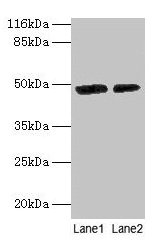 Western blot All lanes: CALR antibody at 2µg/ml Lane 1: EC109 whole cell lysate Lane 2: 293T whole cell lysate Secondary Goat polyclonal to rabbit IgG at 1/10000 dilution Predicted band size: 49 kDa Observed band size: 49 kDa