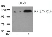 Western blot analysis of extracts from HT29 cells untreated or treated with UV using JAK1(Phospho-Tyr1022) Antibody.