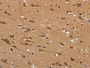 The image on the left is immunohistochemistry of paraffin-embedded Human brain tissue using CSB-PA078815(NDRG3 Antibody) at dilution 1/40, on the right is treated with synthetic peptide. (Original magnification: ×200)