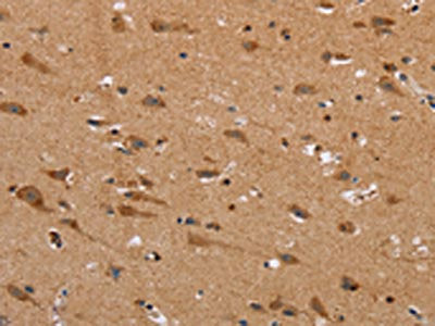 The image on the left is immunohistochemistry of paraffin-embedded Human brain tissue using CSB-PA078815(NDRG3 Antibody) at dilution 1/40, on the right is treated with synthetic peptide. (Original magnification: ×200)