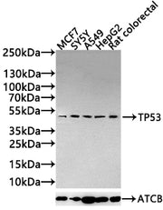 Western Blot Positive WB detected in: MCF7 whole cell lysate(20µg), SY5Y whole cell lysate(20µg), A549 whole cell lysate(20µg), HepG2 whole cell lysate(20µg), Rat colorectal tissue lysate(20µg) All lanes: TP53 antibody at 1:1000 Secondary Goat pol...