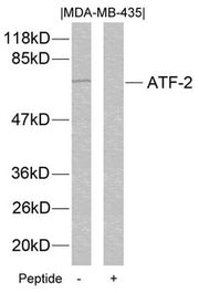 Western blot analysis of extracts from MDA-MB-435 cells using ATF2(Ab-112 or 94) Antibody and the same antibody preincubated with blocking peptide.