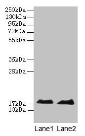 Western blot All lanes: MB antibody at 2µg/ml Lane 1: Rat skeletal muscle tissue Lane 2: Mouse heart tissue Secondary Goat polyclonal to rabbit IgG at 1/10000 dilution Predicted band size: 18 kDa Observed band size: 18 kDa