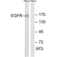 Western blot analysis of extracts from HUVEC cells, using EGFR (Ab-1026) antibody.