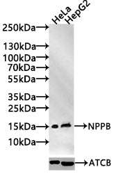 Western Blot Positive WB detected in: Hela whole cell lysate(30µg), HepG2 whole cell lysate(30µg) All lanes: NPPB antibody at 1:1000 Secondary Goat polyclonal to rabbit IgG at 1/20000 dilution Predicted band size: 15 kDa Observed band size: 15 kDa...