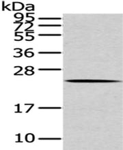 Gel: 12%SDS-PAGE,Lysate: 40 ug,,Primary antibody: CSB-PA079391(ARL2 Antibody) at dilution 1/200 dilution,Secondary antibody: Goat anti rabbit IgG at 1/8000 dilution,Exposure time: 10 seconds