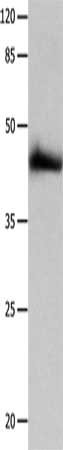 Gel: 10%SDS-PAGE, Lysate: 40 ug, Lane: HT29 cells, Primary antibody: CSB-PA079605(P2RY2 Antibody) at dilution 1/1250, Secondary antibody: Goat anti rabbit IgG at 1/8000 dilution, Exposure time: 1 minute