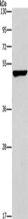 Gel: 8%SDS-PAGE, Lysate: 40 ug, Lane: A549 cells, Primary antibody: CSB-PA079870(CALCRL Antibody) at dilution 1/200, Secondary antibody: Goat anti rabbit IgG at 1/8000 dilution, Exposure time: 5 minutes