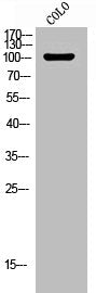 Western Blot analysis of COLO cells using Phospho-JIP-1 (T103) Polyclonal Antibody