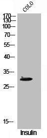 Western Blot analysis of COLO cells using Phospho-CD40 (T254) Polyclonal Antibody