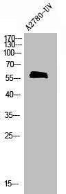 Western Blot analysis of Jurkat cells using Phospho-Cdc25A (S75) Polyclonal Antibody