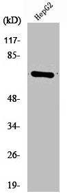 Western Blot analysis of HepG2 cells using Cdc25A Polyclonal Antibody