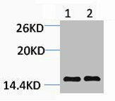 Western blot analysis of 1) Hela, 2) Rat Testis Tissue, diluted at 1:1000.