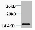 Western blot analysis of Hela, diluted at 1:1000.