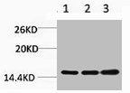 Western blot analysis of 1) Hela, 2) 3T3, 3) Rat Liver Tissue, diluted at 1:1000.
