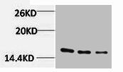 Western blot analysis of 1) Hela, 2) 3T3, 3) Rat Liver Tissue, diluted at 1:1000.