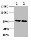Western blot analysis of 1) 3T3, 2) Rat Liver, diluted at 1:2,000.