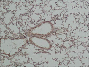 Immunohistochemical analysis of paraffin-embedded Mouse Lung Tissue using GSK3β Polyclonal Antibody.