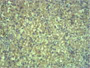 Immunohistochemical analysis of paraffin-embedded Mouse Liver Tissue using EPG5 Polyclonal Antibody.