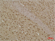Immunohistochemical analysis of paraffin-embedded Rat BrainTissue using MAP LC3β Polyclonal Antibody.