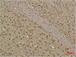 Immunohistochemical analysis of paraffin-embedded Rat BrainTissue using MAP LC3β Polyclonal Antibody.