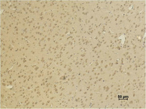 Immunohistochemical analysis of paraffin-embedded Rat BrainTissue using GluR4 Polyclonal Antibody.