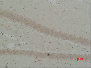 Immunohistochemical analysis of paraffin-embedded Rat Brain Tissue using BEST2 Polyclonal Antibody.