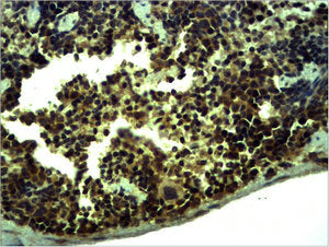 Immunohistochemical analysis of paraffin-embedded Mouse Spleen Tissue using TLR1 Polyclonal Antibody.