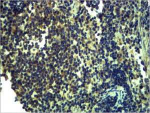 Immunohistochemical analysis of paraffin-embedded Mouse Spleen Tissue using TLR13 Polyclonal Antibody.