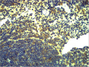 Immunohistochemical analysis of paraffin-embedded Mouse Spleen Tissue using TLR2 Polyclonal Antibody.