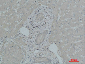 Immunohistochemical analysis of paraffin-embedded Human Liver Tissue using TF Polyclonal Antibody.