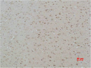 Immunohistochemical analysis of paraffin-embedded Rat Brain Tissue using CASR Polyclonal Antibody.