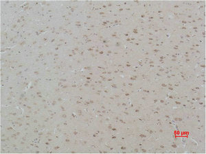 Immunohistochemical analysis of paraffin-embedded Rat Brain Tissue using CASR Polyclonal Antibody.