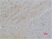Immunohistochemical analysis of paraffin-embedded Rat Brain Tissue using CACNB3 Polyclonal Antibody.
