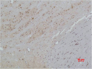 Immunohistochemical analysis of paraffin-embedded Rat Brain Tissue using CACNB3 Polyclonal Antibody.