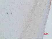 Immunohistochemical analysis of paraffin-embedded Rat Brain Tissue using CACNG2 Polyclonal Antibody.