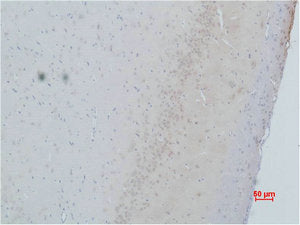 Immunohistochemical analysis of paraffin-embedded Rat Brain Tissue using CACNG2 Polyclonal Antibody.