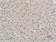 Immunohistochemical analysis of paraffin-embedded Rat Brain Tissue using CACNG3 Polyclonal Antibody.
