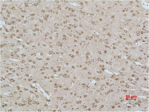 Immunohistochemical analysis of paraffin-embedded Rat Brain Tissue using CACNG3 Polyclonal Antibody.