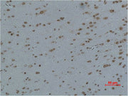Immunohistochemical analysis of paraffin-embedded Rat Brain Tissue using L-type Ca++ CP γ4 Polyclonal Antibody.