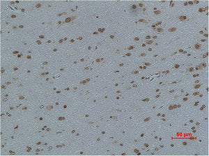 Immunohistochemical analysis of paraffin-embedded Rat Brain Tissue using L-type Ca++ CP γ4 Polyclonal Antibody.