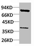 Western blot analysis of HepG2 using PI 3-kinase p85α Polyclonal Antibody.